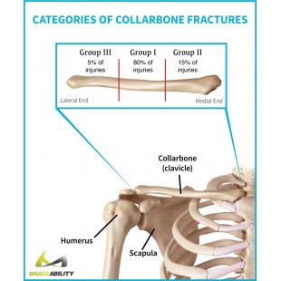 Dinex DXCMTXTS 12 Inch Commercial Tray Slide 3-Bar with Steel Construction