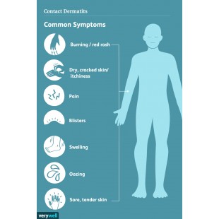 Fortessa G16-I-155H Full Size Dishwasher Rack Extender Polycarbonate Yellow Fortessa G16-I-155H Full Size Dishwasher Rack Extender Polycarbonate Yellow