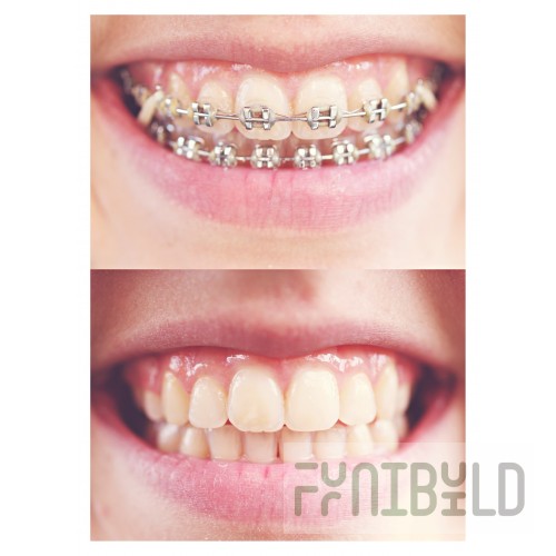 Amerikooler DF061277**FBSM 5'-10 5/8