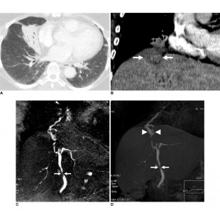 Amerikooler DW092077N-10/10 8-7/8 Inch Indoor Cooler Freezer Box Only with NSF Aluminum